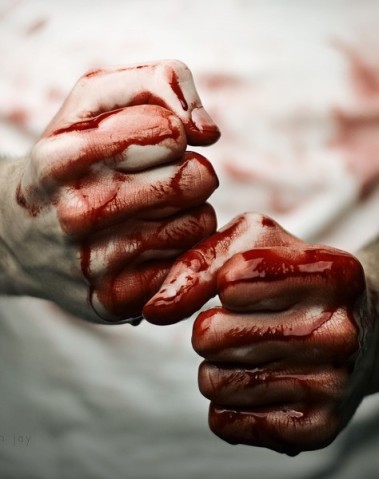 bleeding-out